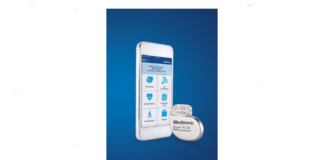 AzurewithBlueSync_69841