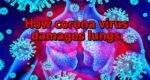 How coronavirus damages lungs