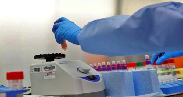 RT PCR1 RT PCR Test