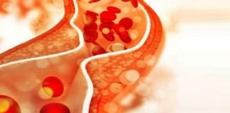 cholesterol-lowering-medications