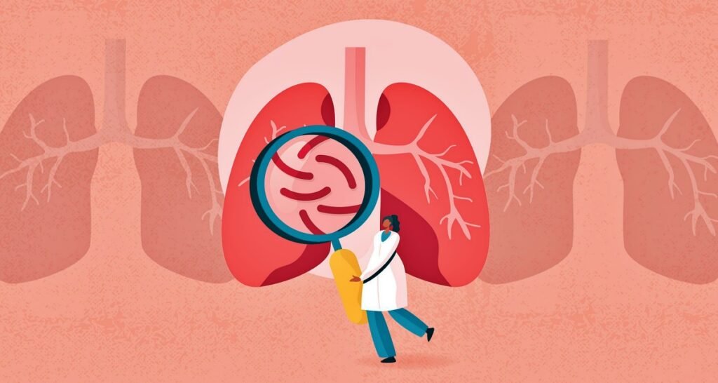 TB can cause persistent cough after corona