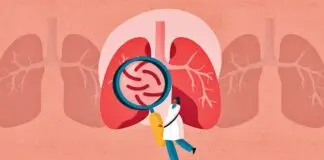 TB can cause persistent cough after corona