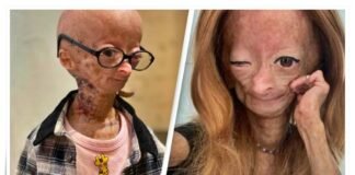 YouTube-star-Adalia-Rose