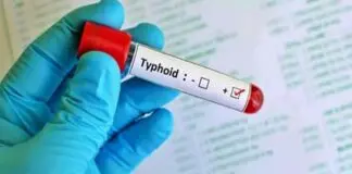 Typhoid will no longer be cured easily