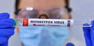 monkeypox