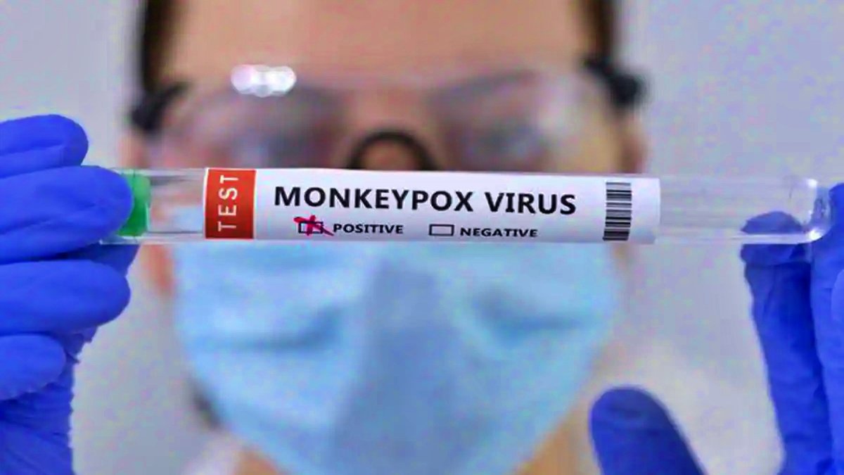 Monkeypox strain found in country is not a super spreader, genome sequencing revealed
