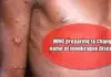 WHO preparing to change name of monkeypox disease, this is the reason Monkey-pox