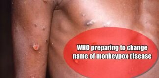 Monkey-pox