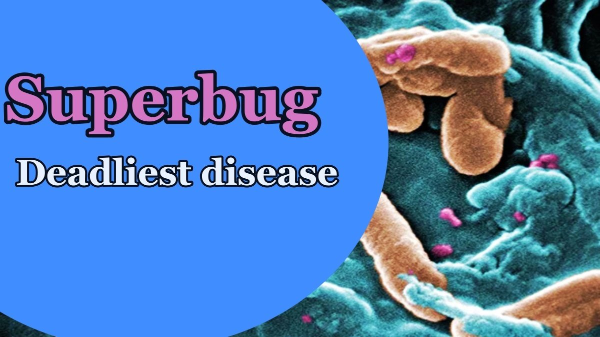 Deadliest disease Superbug wreaks havoc,10 million people will lose lives in a year!