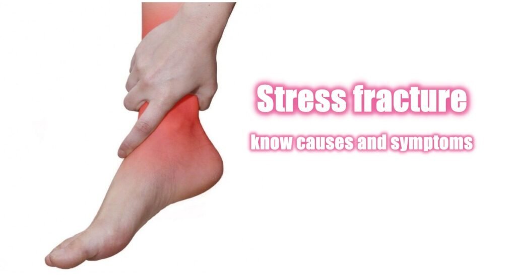 stress-fracture