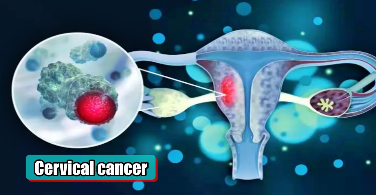 Government should start national mission on Cervical cancer, lives can be saved due to introduction of 5G technology