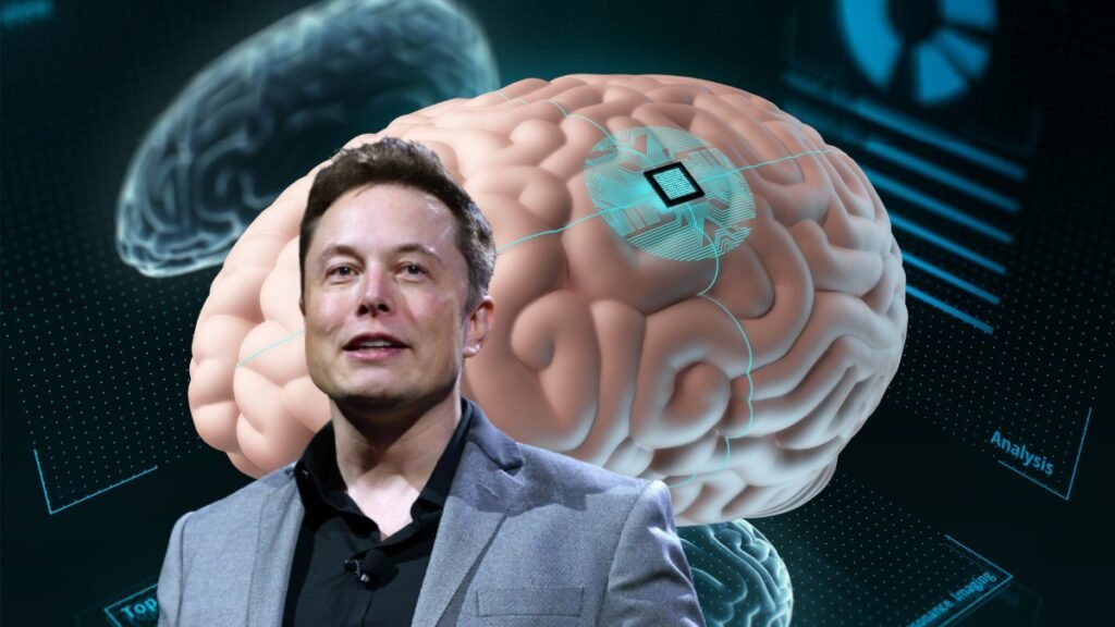 brain chip-Elon-musk