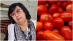 Pratibha Shukla on tomato prices