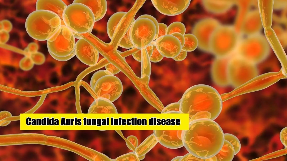 ‘Candida Auris’ threat of fungal infection disease is hovering all over the world