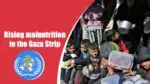 rising malnutrition in the Gaza Strip
