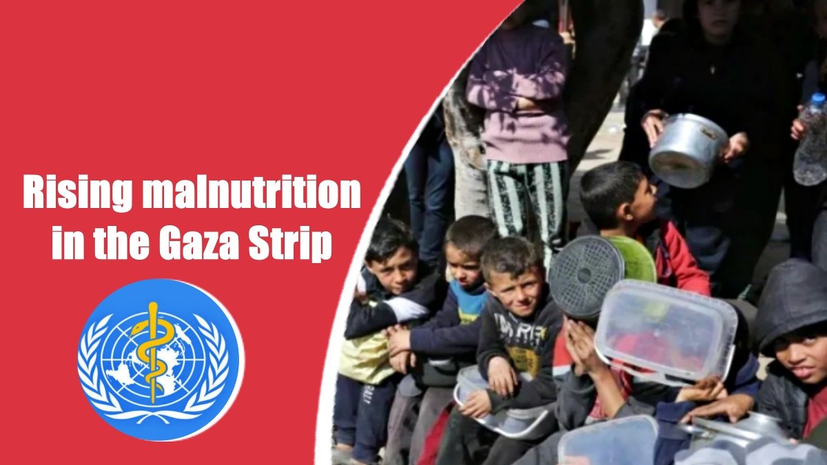 Children’s lives threatened by rising malnutrition in the Gaza Strip