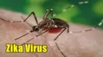 Zika Virus