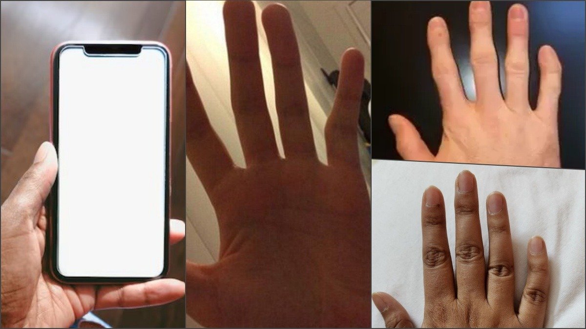 Smartphone Finger No More: Practical Solutions for Mobile Users