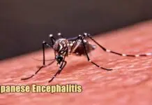 Japanese Encephalitis