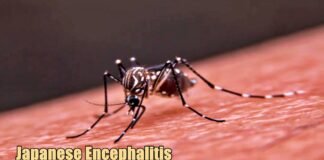 Japanese Encephalitis
