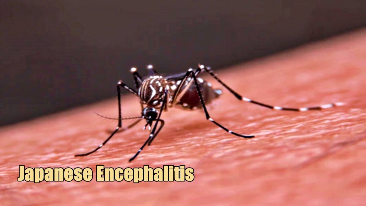 Rising Threat of Japanese Encephalitis: Protecting Children as Winter Brings Increased Risks