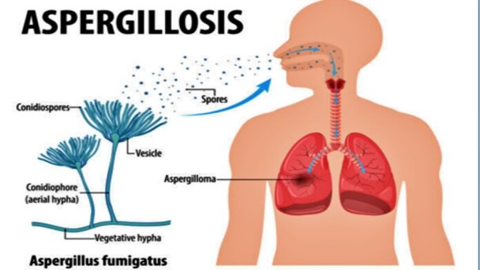 Aspergillus fumigatus Aspergillus fumigatus