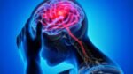 Neurological Disorders