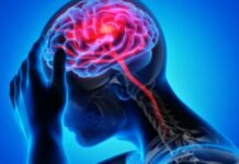 Neurological Disorders