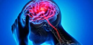 Neurological Disorders