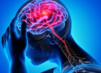 Neurological Disorders