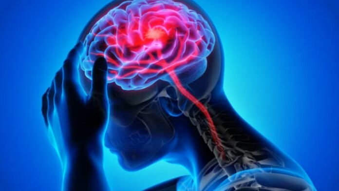 Neurological Disorders Neurological Disorders